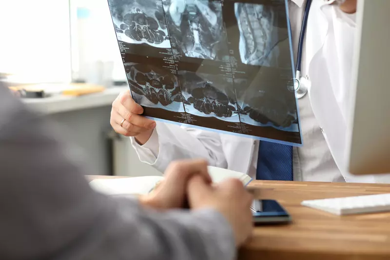 A doctor discussing a scan to a patient